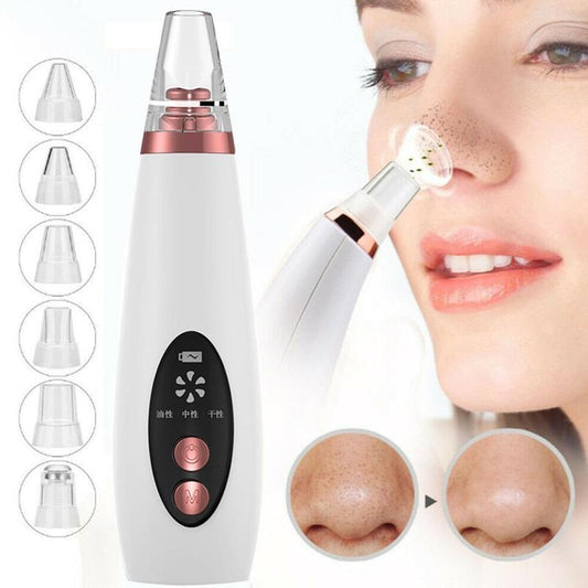 Blackhead Pore Vacuum  Nose Cleaner